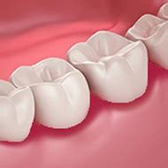 gum disease treatment bradenton fl|Rubino Periodontics and Implant Dentistry .